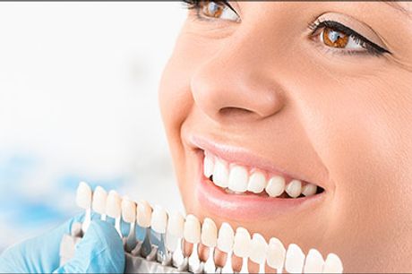  Få et flottere smil med EU godkendt SmileZERO tandblegning! - SmileZERO tandblegning hos Denise, Cliniq Queen, værdi kr. 999,- 