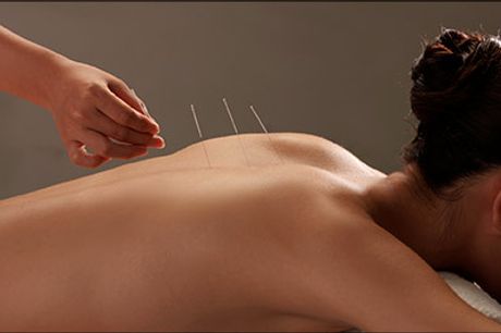  Få kroppen i bedre balance med akupunktur - Akupunkturbehandling hos Akupunktur, Zoneterapi & Massage, værdi kr. 395,- 