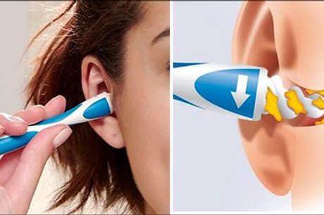  Rens dine ører nemt og effektivt! - Easy Earwax Removal fra Try Us ApS, værdi kr. 296,-  