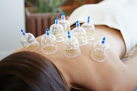 20-Minute Cupping Session, 30-Minute Acupuncture Session or Both at Natural Health