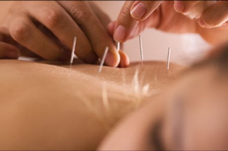  Smertelindring med alternativ behandling - Rigtig god deal - Prøv 30 minutters akupunkturbehandling hos Body Cares til en værdi af kr. 300,- 