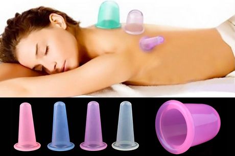 £12.99 instead of £29.92 for a set of eight Glamza suction massage cups from Forever Cosmetics - save 67%
