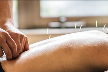  Få en sund krop - Effektiv behhandling med akupunktur, varighed 60 minutter. Værdi kr. 490,- 