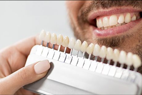  Få det flotteste hvide smil - Du får det flotteste tandpastasmil med en tandblegning i klinikken eller hjemmeblegning, værdi op til kr. 2600,- 
