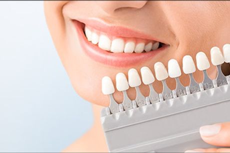  Få dit flotte hvide smil tilbage - Få 60 min. tandblegning fra ONLYSMILE, der er førende blandt alle brands på markedet. Værdi kr. 995,- 