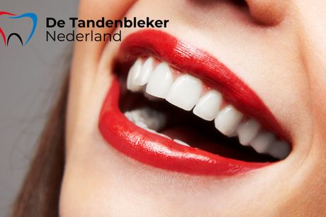  1, 5 of 10 tandenbleekbehandeling(en) bij De Tandenbleker Nederland 