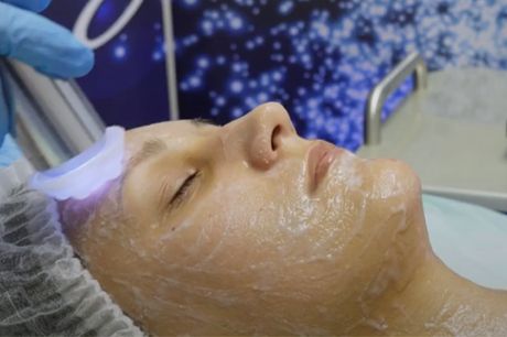 Eksklusiv ansigtsbehandling. Få en eksklusiv carboxy ansigtsbehandling inkl. lysterapi og ultralyd hos Wedderkoppstyle Beauty Studio nær Aarhus.